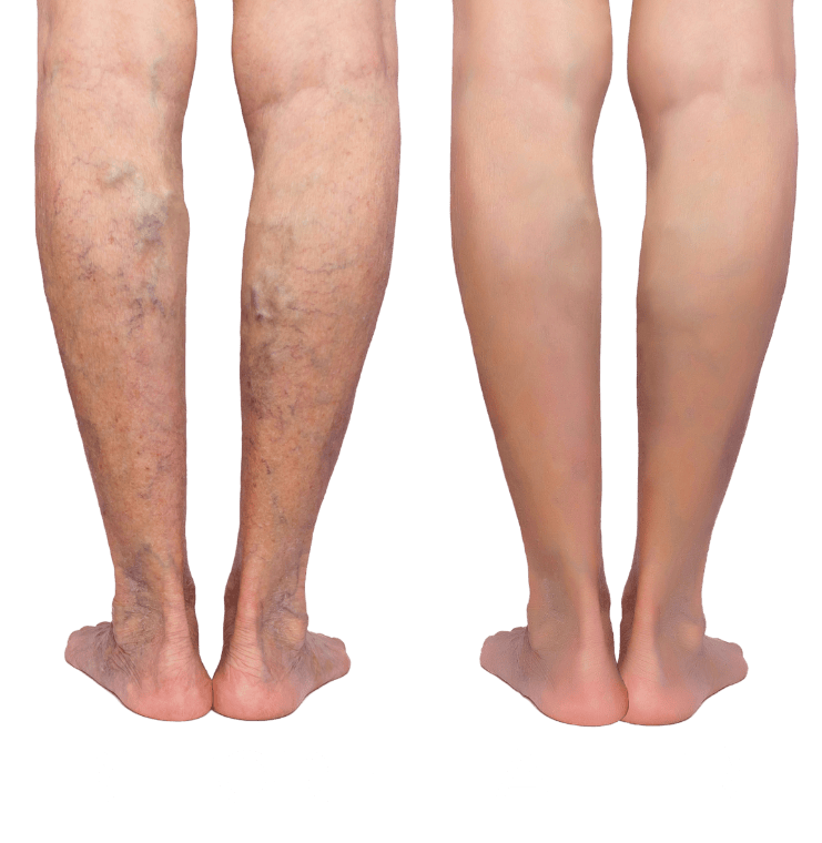 Before After Desktop