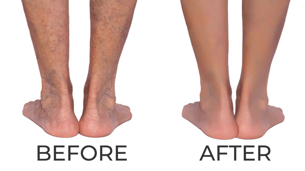 Before After Mobile